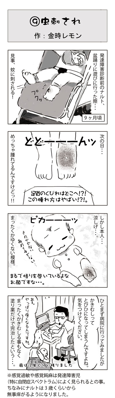 金時レモンのゆるゆる発達障害児育児日記 発達障害のサイン！？！感覚鈍麻　虫刺され